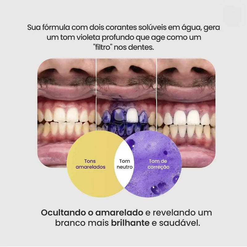 Clareador Dentário - Sérum V34™